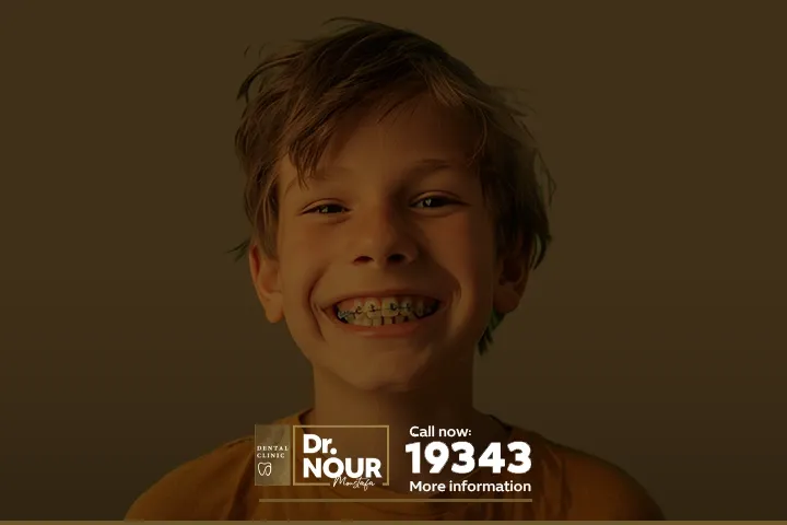تقويم الاسنان للاطفال
