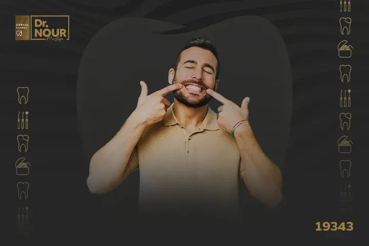 ما هو الفينير للاسنان