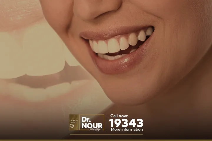 اهم انواع تبييض الاسنان